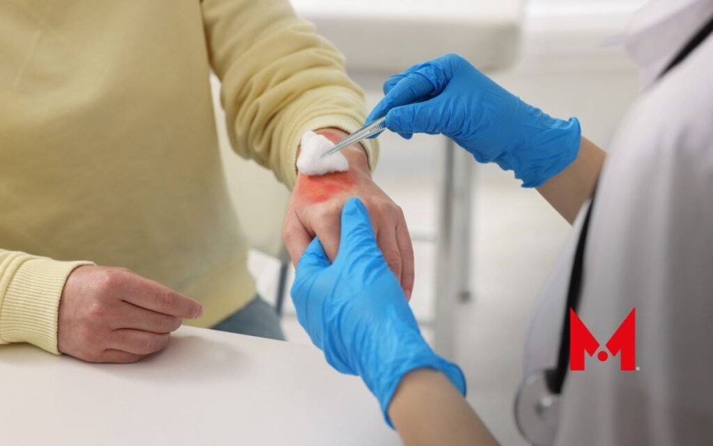 Pelea en la alcaldía Gustavo A. Madero deja a joven con quemaduras graves